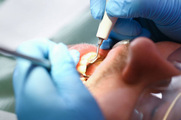 Best Cosmetic Emergency Dentistry in Parkland, WA