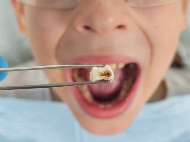 Best Weekend Emergency Dentist in Parkland, WA